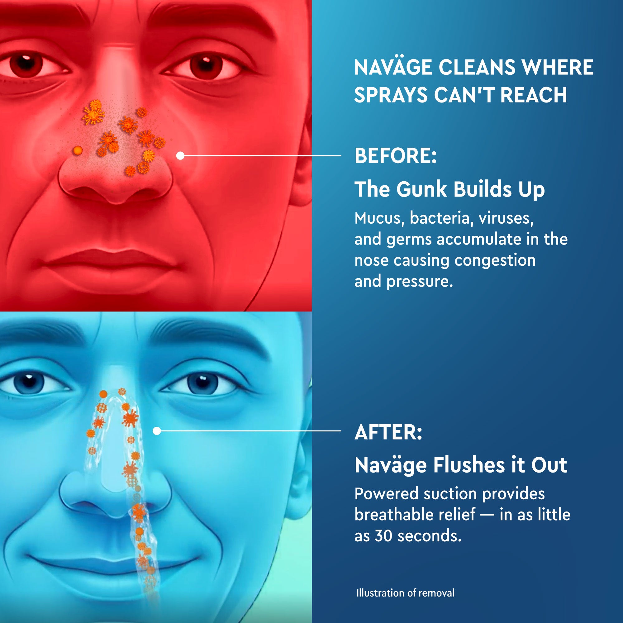 Naväge Essentials Plus Bundle: Nose Cleaner, 30 SaltPods, Countertop Caddy, Custom Cleaning Kit